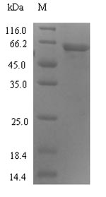 Recombinant Human Uncharacterized protein C4orf29(C4orf29)