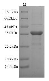Recombinant Human T-cell surface glycoprotein CD1c(CD1C),partial
