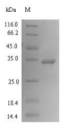 Recombinant Human Phosphoethanolamine/phosphocholine phosphatase(PHOSPHO1)