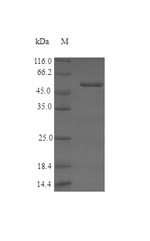 Recombinant Human Serine racemase(SRR)