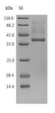 Recombinant Mouse Ubiquitin-protein ligase E3A(Ube3a),partial