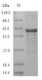 Recombinant Human Protein unc-119 homolog A(UNC119)