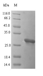 Recombinant Cyprinus carpio Parvalbumin(cyp c 1.02)