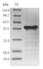 Recombinant Penaeus monodon Sarcoplasmic calcium binding protein