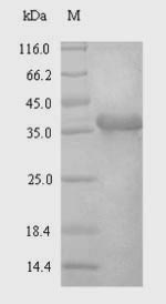 Recombinant Human Syndecan-4(SDC4),partial