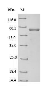 Recombinant Bovine Aspartate aminotransferase, mitochondrial(GOT2)