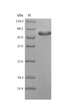 Recombinant Mycoplasma pneumoniae Putative proline iminopeptidase(pip)