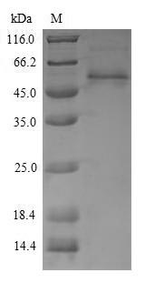 Recombinant Penaeus monodon Arginine kinase(AK)