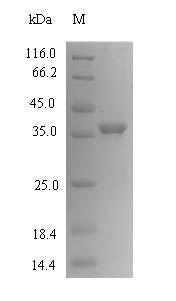 Recombinant Mouse UMP-CMP kinase(Cmpk1)