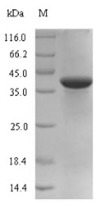 Recombinant Mycoplasma pneumoniae Uncharacterized lipoprotein MPN_083(MPN_083),partial