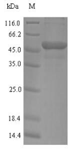 Recombinant Human Myosin-binding protein C, fast-type(MYBPC2),partial