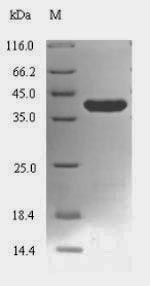 Recombinant Mycoplasma pneumoniae Lon protease(lon),partial