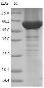 Recombinant Human Steroid 21-hydroxylase(CYP21A2)