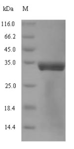 Recombinant Mycoplasma pneumoniae Chaperone protein DnaK(dnaK) ,partial