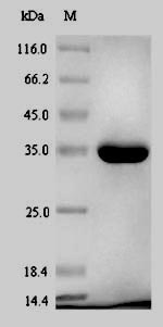 Recombinant Escherichia coli Phosphoheptose isomerase(gmhA)