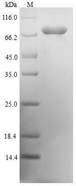Recombinant Human mRNA-decapping enzyme 1A(DCP1A)
