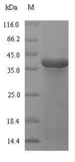 Recombinant Mycoplasma pneumoniae Oligoendopeptidase F homolog(pepF),partial