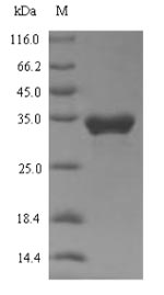 Recombinant Human Transient receptor potential cation channel subfamily A member 1(TRPA1),partial