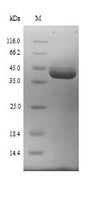 Recombinant Mouse Ubiquitin-protein ligase E3A(Ube3a),partial