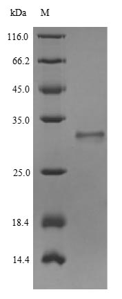 Recombinant Human Unconventional myosin-VIIa(MYO7A),partial