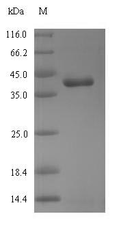 Recombinant Chicken (Chicken) Mitochondrial Rho GTPase 1(RHOT1),partial