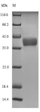 Recombinant Xenopus laevis Histone H1.0-A(h1f0-a)
