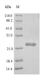 Recombinant Mouse Single Ig IL-1-related receptor(Sigirr),partial