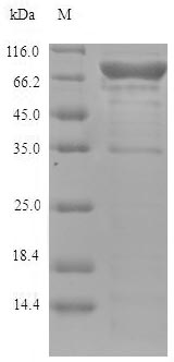 Recombinant Human Lysyl oxidase homolog 4(LOXL4)