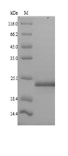 Recombinant Human Mediator of DNA damage checkpoint protein 1(MDC1),partial