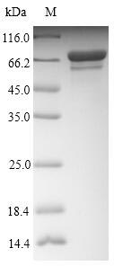 Recombinant Influenza A virus Nucleoprotein(NP)