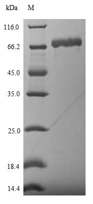 Recombinant Influenza A virus Nucleoprotein(NP)