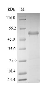 Recombinant Mouse Aminoacyl tRNA synthase complex-interacting multifunctional protein 1(Aimp1)