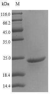 Recombinant Carpinus betulus Major pollen allergen Car b 1 isoform 2