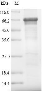 Recombinant Human Optineurin(OPTN)