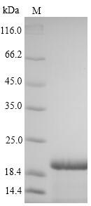 Recombinant Hepatitis B virus genotype C subtype adr Large envelope protein(S),partial