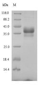 Recombinant Mouse Anthrax toxin receptor 1(Antxr1),partial