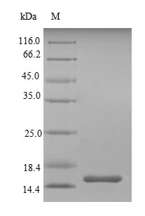 Recombinant Mouse Single Ig IL-1-related receptor(Sigirr)