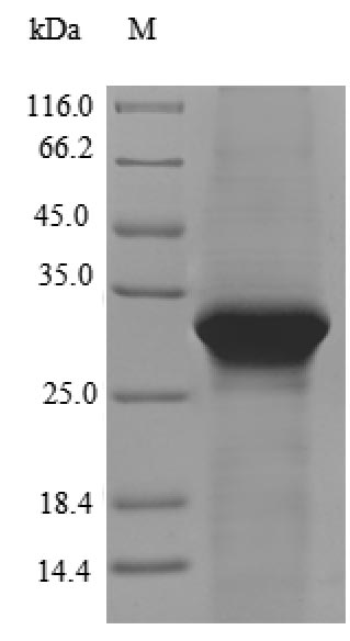 Recombinant Human Lipolysis-stimulated lipoprotein receptor(LSR)