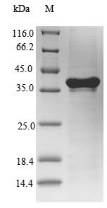 Recombinant Mouse Interleukin-7 receptor subunit alpha(Il7r),partial