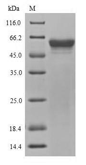 Recombinant Outer membrane protein yopM(yopM)