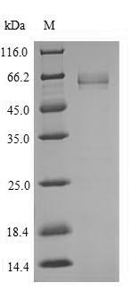 Recombinant Human Transcription factor 7-like 2(TCF7L2),partial