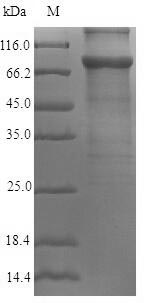 Recombinant Human A-kinase anchor protein 4(AKAP4)