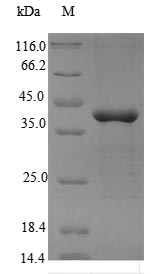 Recombinant Human 5'-AMP-activated protein kinase subunit gamma-2(PRKAG2)