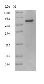 Recombinant Human Retinal dehydrogenase 2(ALDH1A2)
