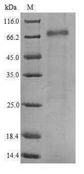 Recombinant Human mRNA-decapping enzyme 1B(DCP1B)