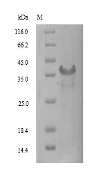 Recombinant Human Signal-regulatory protein gamma(SIRPG),partial