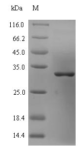 Recombinant Chlamydia pneumoniae Large cysteine-rich periplasmic protein OmcB(omcB),partial