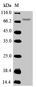 Recombinant Human UDP-glucuronosyltransferase 1-4(UGT1A4)