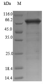 Recombinant Rat Neuroendocrine convertase 2(Pcsk2)