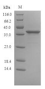Recombinant Human Signal-regulatory protein beta-1(SIRPB1),partial